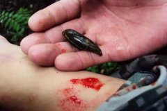 螞蟥咬人怎么辦？螞蟥怎么能殺死？
